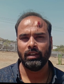 अंजड़ में विद्युत ठेकेदार वाजिद खान से कुछ लोगों ने मारपीट कर घायल कर दिया , पुलिस ने मामला दर्ज किया